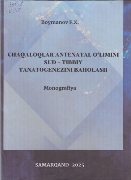 Chaqaloqlar antenatal o'limini sud-tibbiy tanotogenezini baholash