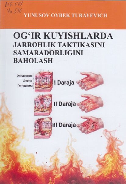 Og‘ir kuyishlarda jarrohlik taktikasini samaradorligini baholash