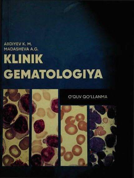 Klinik gematologiya