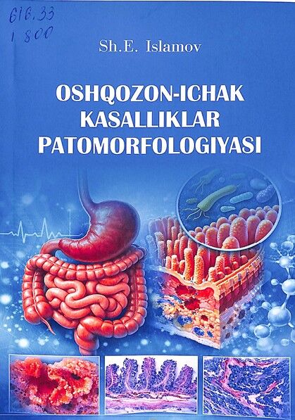 Oshqozon-ichak kasalliklar patomorfologiyasi