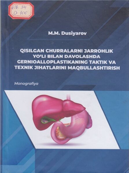 Qisilgan churralarni jarrohlik yo‘li bilan davolashda gernioalloplastikaning taktik va texnik jihatlarini maqbullashtirish