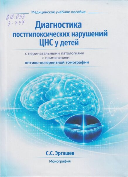Диагностика постгипоксических нарушений ЦНС у детей с перинатальными патологиями с применением оптико-когерентной томографии