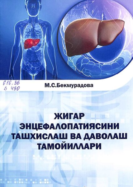 Жигар энцефалопатиясини ташхислаш ва даволаш тамойиллари