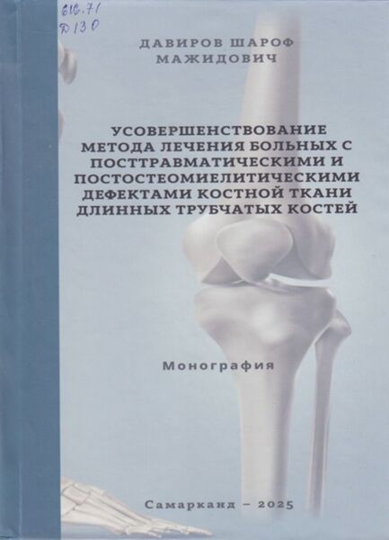 Усовершенствование метода лечения больных с посттравматическими и постостеомиелитическими дефектами костной ткани длинных трубчатых костей