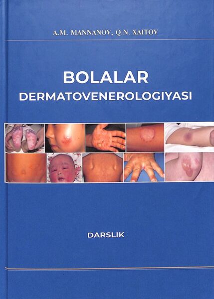Bolalar dermatovenerologiyasi