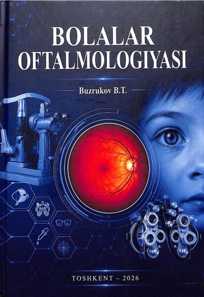 Bolalar oftalmologiyasi