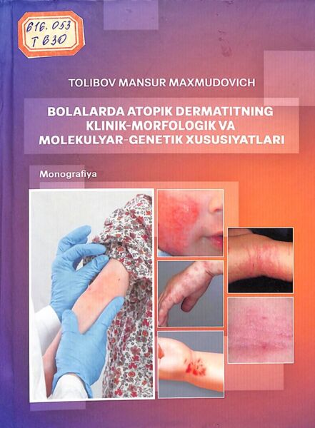 Bolalarda atopik dermatitning klinik-morfologik va molekulyar-genelik xususiyatlari 