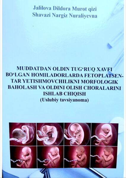 Muddatdan oldin tug‘ruq xavfi bo'lgan homiladorlarda fetoplatsentar yetishmovchilikni morfologik baholash va oldini olish choralarini ishlab chiqish