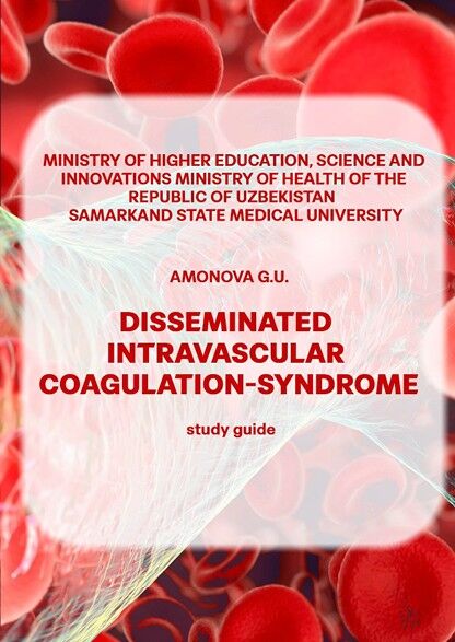 Disseminated intravascular coagulation-syndrome