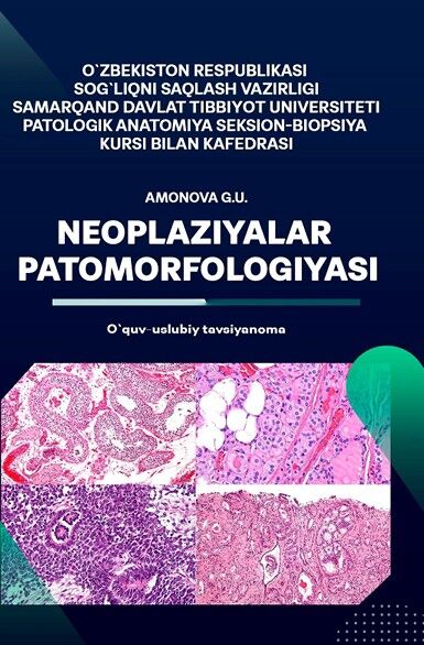 Neoplaziyalar patomorfologiyasi