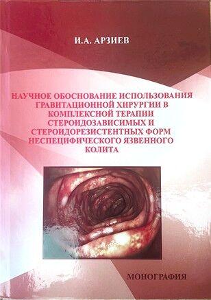 Научное обоснование использования гравитационной хирургии в комплексной терапии стероидозависимых и стероидорезистентных форм неспецифического язвенного колита 
