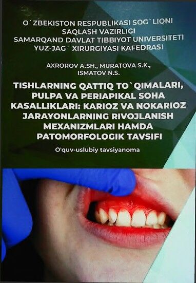 Tishlarning qattiq to’qimalari, pulpa va periapikal soha kasall1klari: karioz va nokarioz jarayonlarning rivojlanish mexanizmlari hamda patomorfologik tavsifi