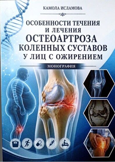 Особенности течения и лечения остеоартроза коленных суставов улиц с ожирением