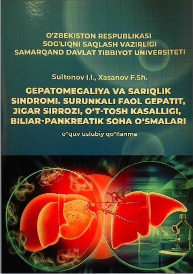 Gepatomegaliya va sariqlik sindromi. Surunkali faol gepatit, jigar sirrozi, o't-tosh kasalligi, biliar-pankreatik soha o‘smalari. 