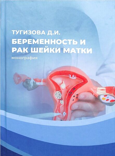Беременность и рак шейки матки