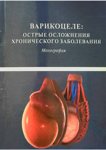 Варикоцеле. Острые осложнения хронического заболевания. Монография. С. Аллазов. Самарканд-2026.