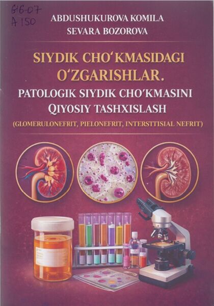 Siydik cho‘kmasidagi o‘zgarishlar. patologik siydik cho kmasini qiyosiy tashxislash (glomerulonefrit, pielonefrit, interstitsial nefrit)