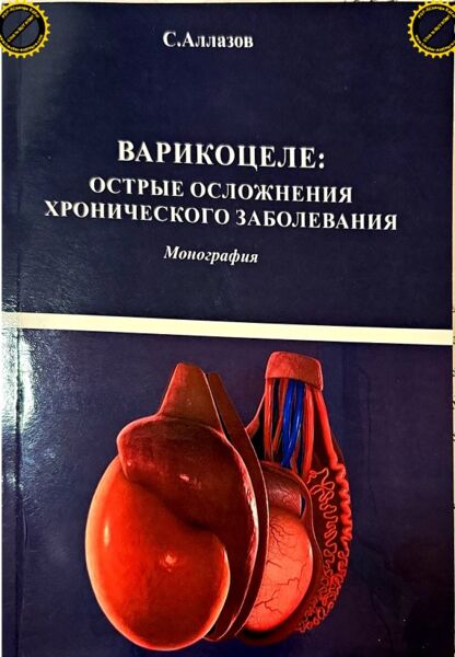 Варикоцеле: острые осложнения хронического заболевания