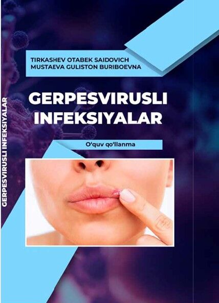 Gerpesvirusli infeksiyalar
