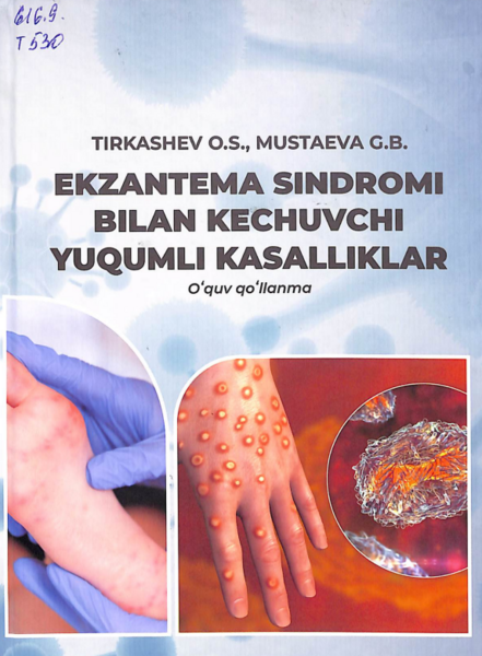 Ekzantema sindromi bilan kechuvchi yuqumli kasalliklar