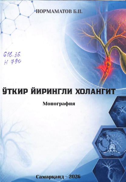 Ўткир йирингли холангит