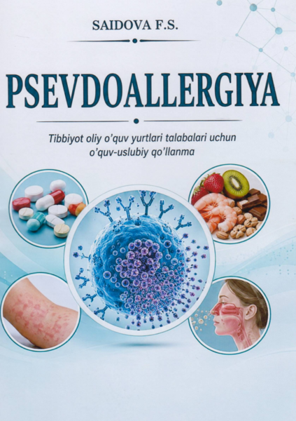 Psevdoallergiya