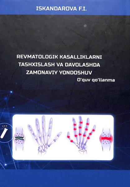 Revmatologik kasalliklarni tashxislash va davolashda zamonaviy yondoshuv