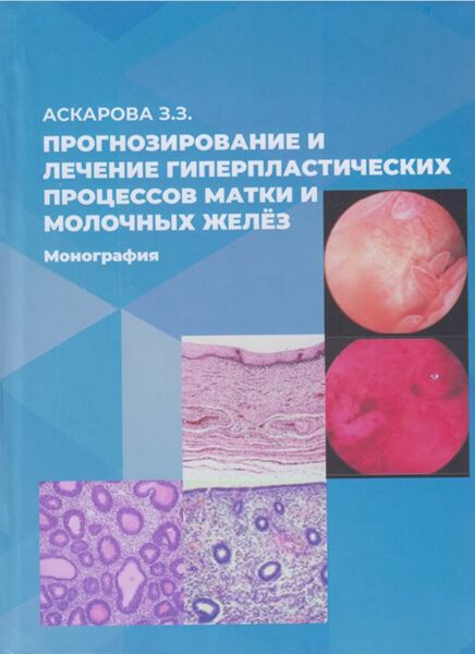 Прогнозирование и лечение гиперпластических процессов матки и молочных желёз