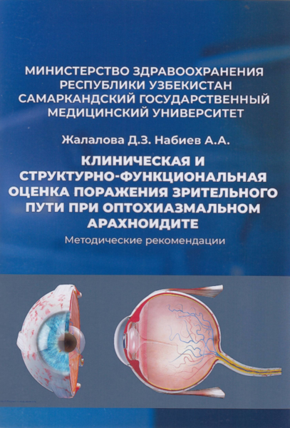 Клиническая и структурно-функциональная оценка поражения зрительного пути при оптохиазмальном арахноидите