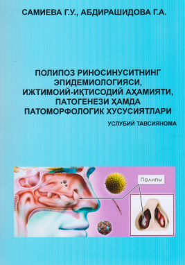 Полипоз риносинуситнинг эпидемиологияси, ижтимоий-иқтисодий аҳамияти, патогенези ҳамда патоморфологик хусусиятлари