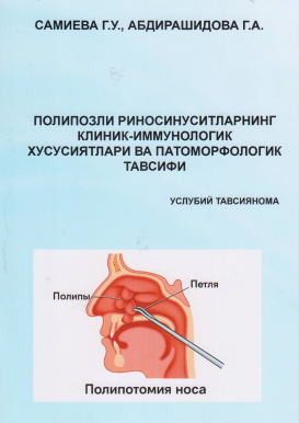 Полипозли риносинуситларнинг клиник-иммунологик хусусиятлари ва патоморфологик тавсифи