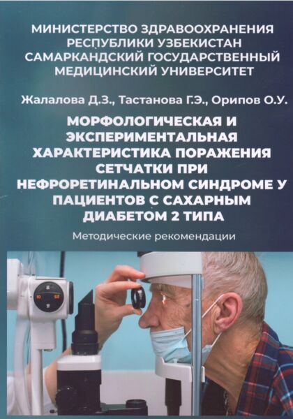 Морфологическая и экспериментальная характеристика поражения сетчатки при нефроретинальном синдроме у пациентов с сахарным диабетом 2 типа 