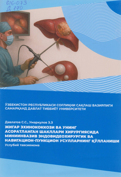 Жигар эхинококкози ва унинг асоратланган шакллари хирургиясида миниинвазив эндовидеохирургик ва навигацион - пункцион усулларнинг қўлланиши
