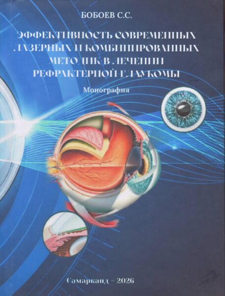 Эффективность современных лазерных и комбинированных методик в лечении рефрактерной глаукомы