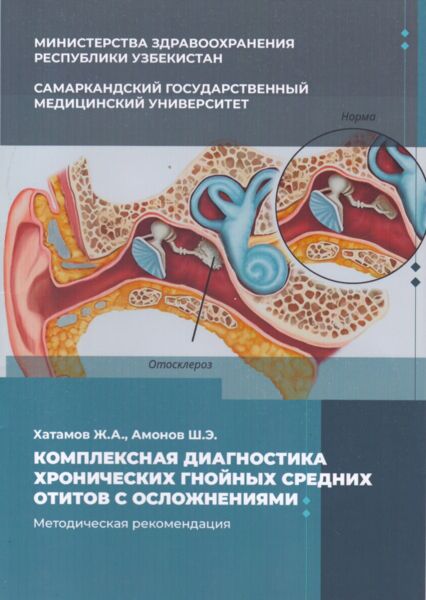 Комплексная диагностика хронических гнойных средних отитов с осложнениями