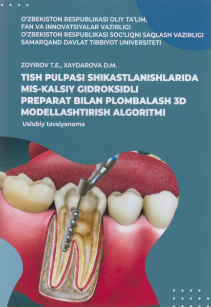 Tish pulpasi shikastlanishlarida mis-kalsiy gidroksidli preparat bilan plombalash 3D modellashtirish algoritmi