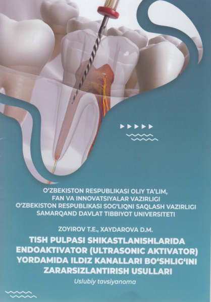 Tish pulpasi shikastlanishlarida endoaktivator (ultrasonic aktivator) yordamida ildiz kanallari bo`shlig`ini zarasizlantirish usullari