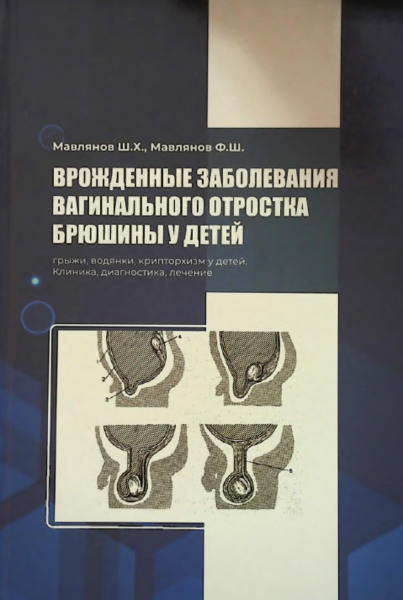 Врожденные заболевания вагинального отростка брюшины у детей (грыжи, водянки, крипторхизм у детей, клиника, диагностика и лечение)