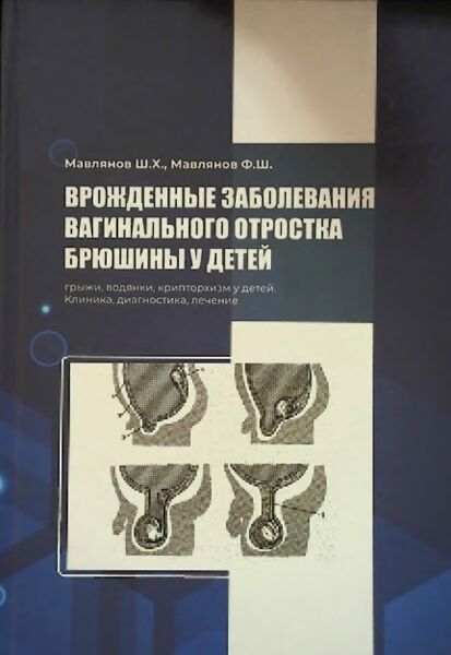 Врожденные заболевания вагинального отростка брюшины у детей
