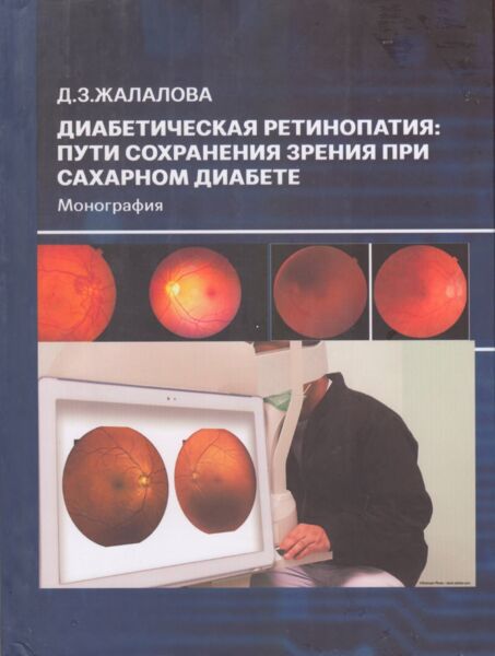 Диабетическая ретинопатия пути сохранения зрения при сахарном диабете