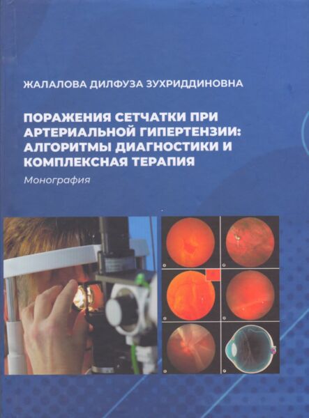 Поражения сетчатки при артериальной гипертензии: алгоритмы диагностики и комплексная терапия