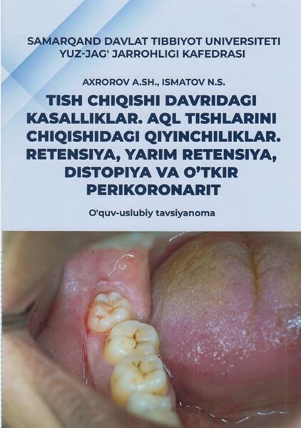 Tish chiqishi davridagi kasalliklar. Aql tishlarini chiqishidagi qiyinchiliklar. Retensiya, yarim retensiya, distopiya va o’tkir perikoronarit.