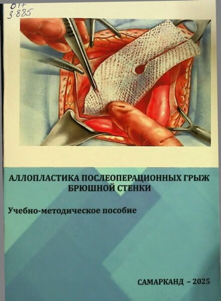 Аллопластика послеоперационных грыж брюшной стенки