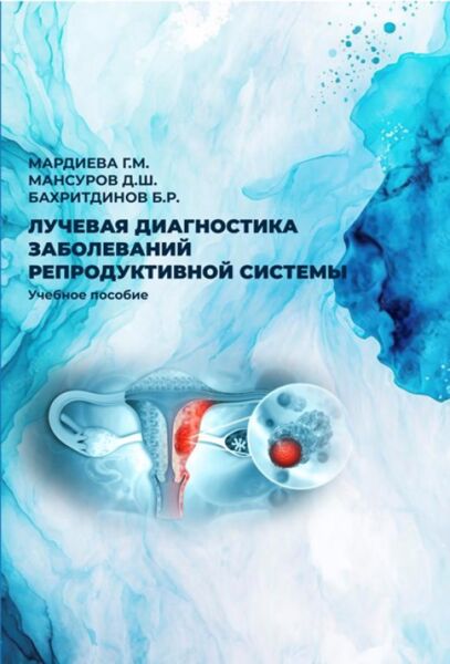 Лучевая диагностика заболеваний репродуктивной системы