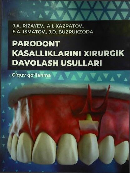 Parodont kasalliklarini xirurgik davolash usullari