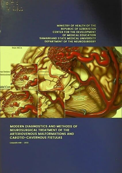 Modern diagnostics and methods of neurosurgical treatment of the arteriov enous malformations and carotid- cavernous fistulas. Mamadaliev A.M