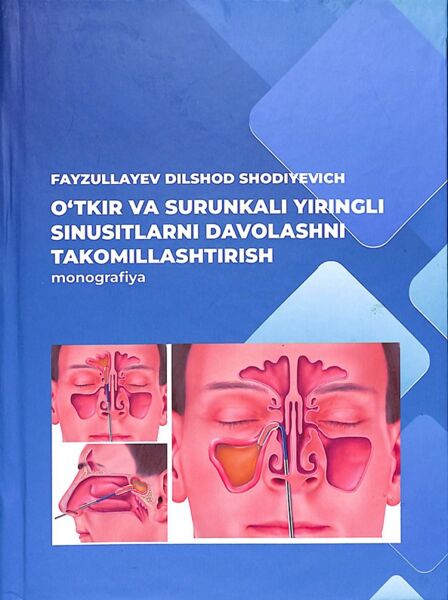 O‘tkir va surunkali yiringlii sinusitlami davolashni takomillashtirish. Monografiya. Fayzullayev D.Sh