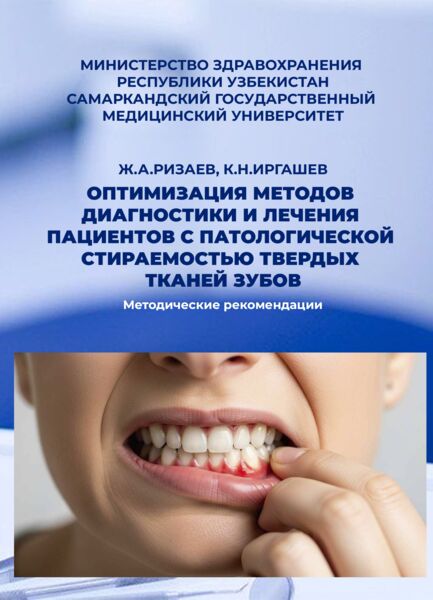 Оптимизация методов диагностики и лечения пациентов с патологической стираемостью твердых тканей зубов. Методические рекомендации